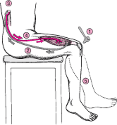 रिफ़्लेक्स आर्क: एक नो-ब्रेनर