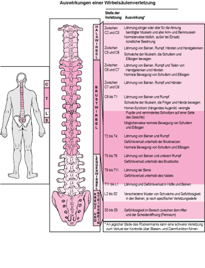 Welcher Bereich des Rückenmarks ist geschädigt?