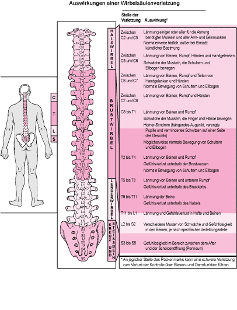 Welcher Bereich des Rückenmarks ist geschädigt?