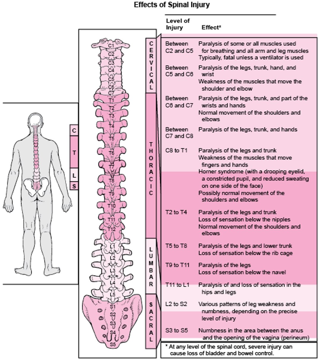 ¿Dónde está dañada la médula espinal?