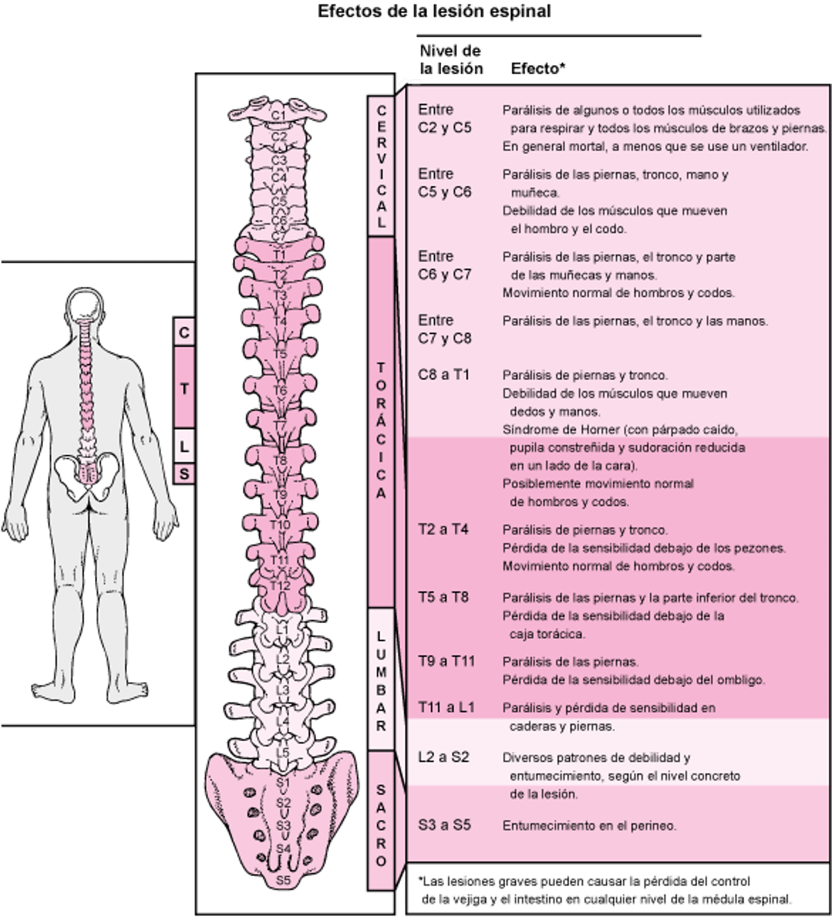 ¿Dónde está dañada la médula espinal?