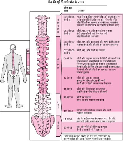 स्पाइनल कॉर्ड कहां से क्षतिग्रस्त है?