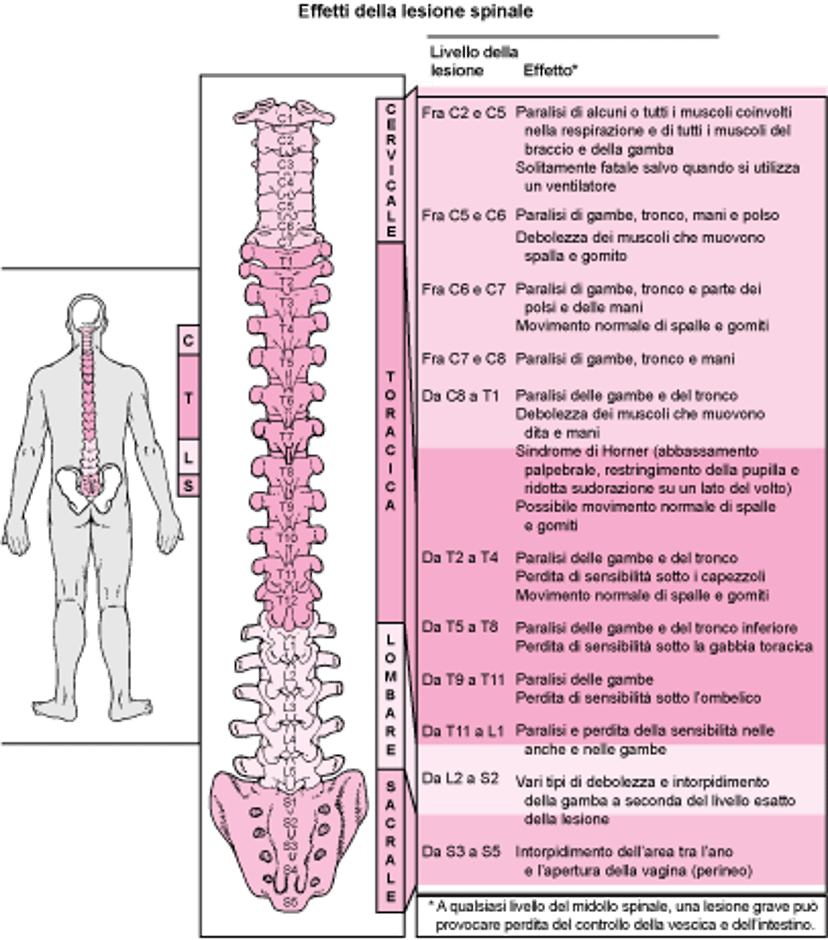 Dov’è danneggiato il midollo spinale?