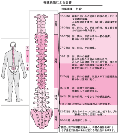 脊髄の損傷領域とその影響