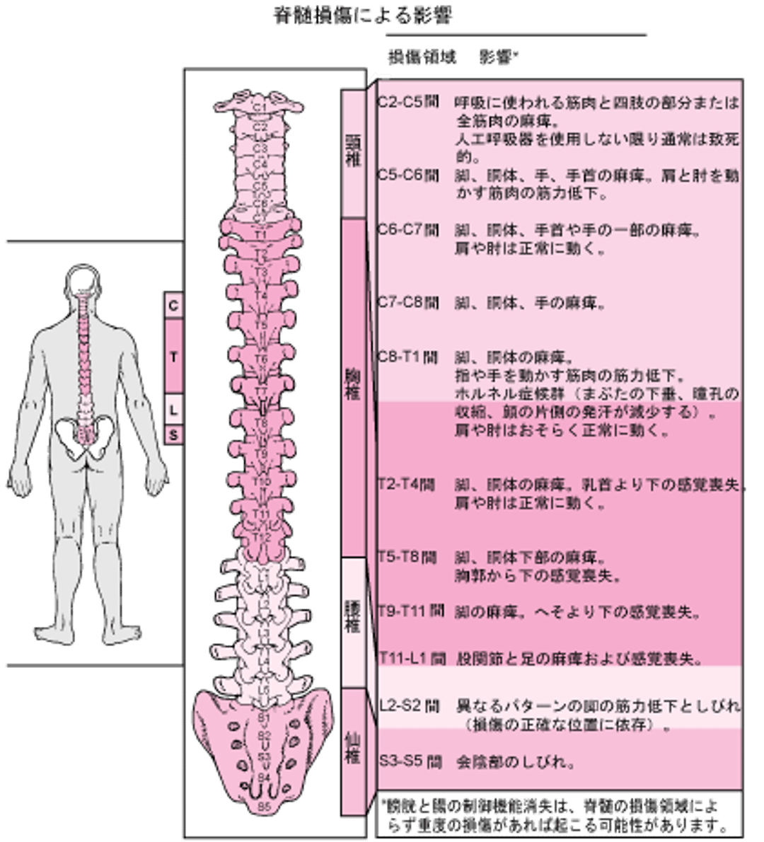 脊髄の損傷領域とその影響