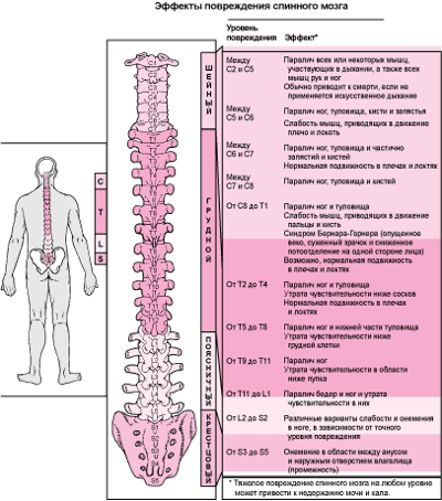 Места повреждений спинного мозга?