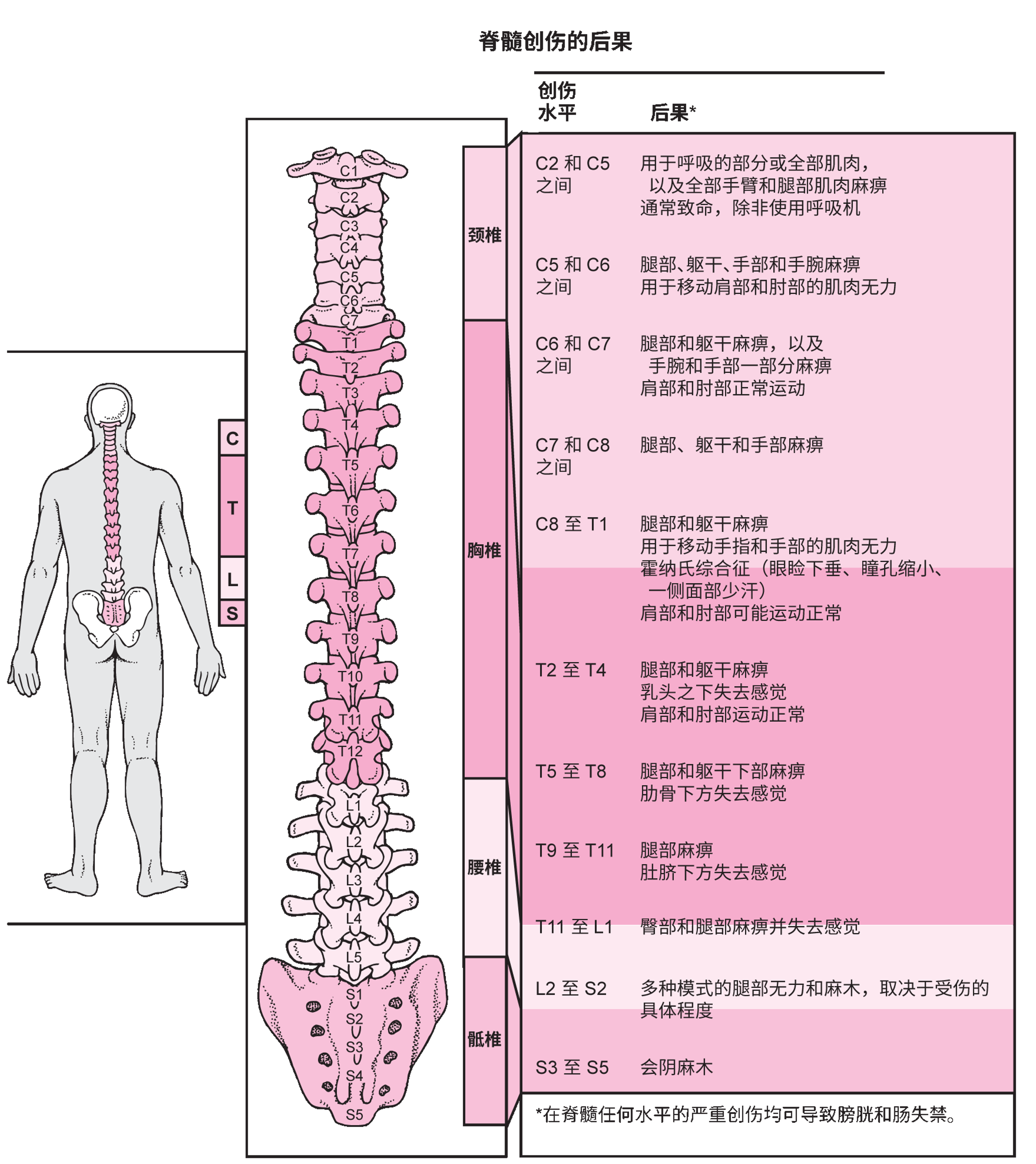 脊髓哪个部位损伤？