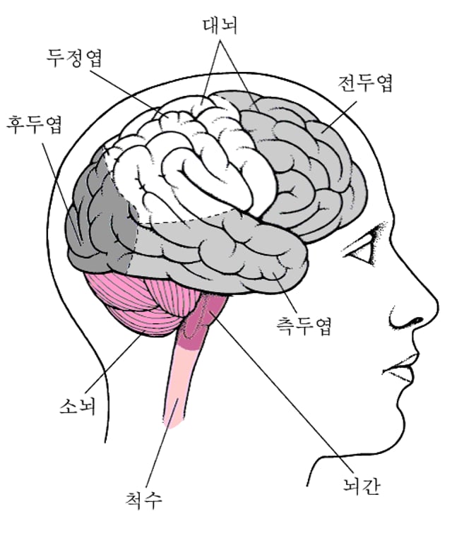위치별 뇌기능장애 - 뇌, 척수, 신경 장애 - MSD 매뉴얼 - 일반인용