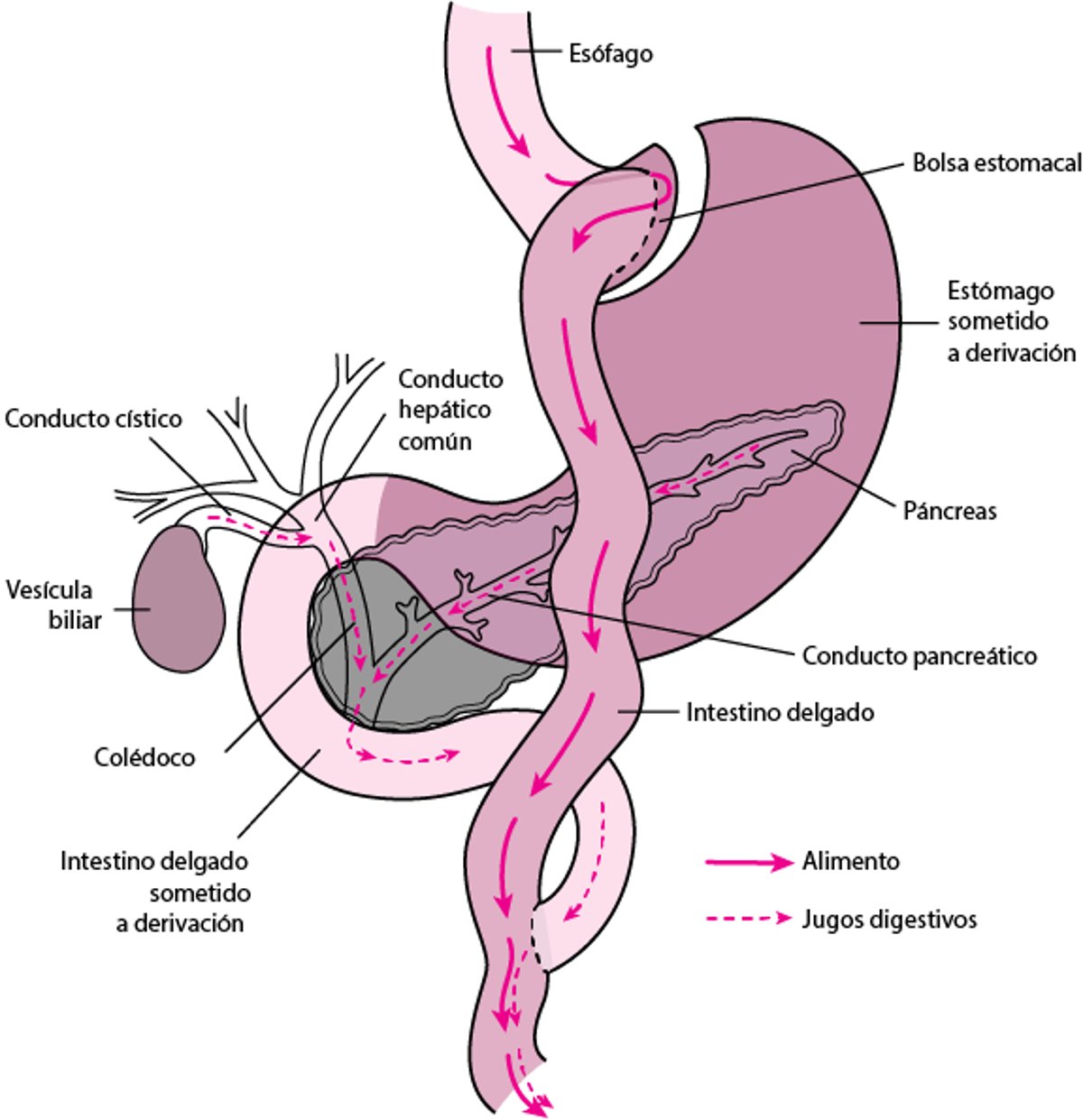 Derivación de parte del tubo digestivo