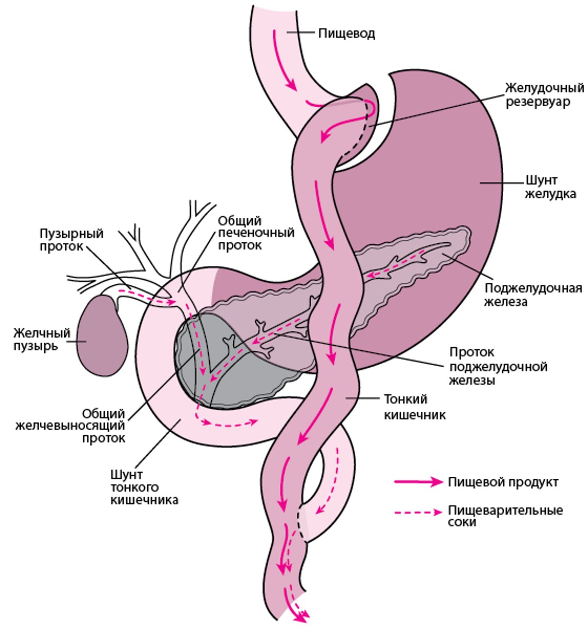 Обход части пищеварительного тракта