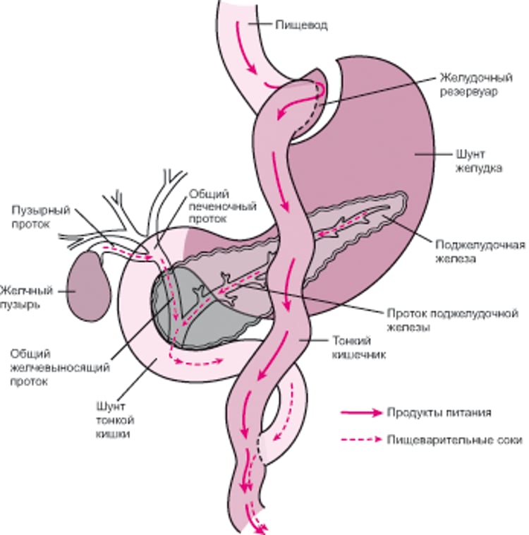 Обход части пищеварительного тракта