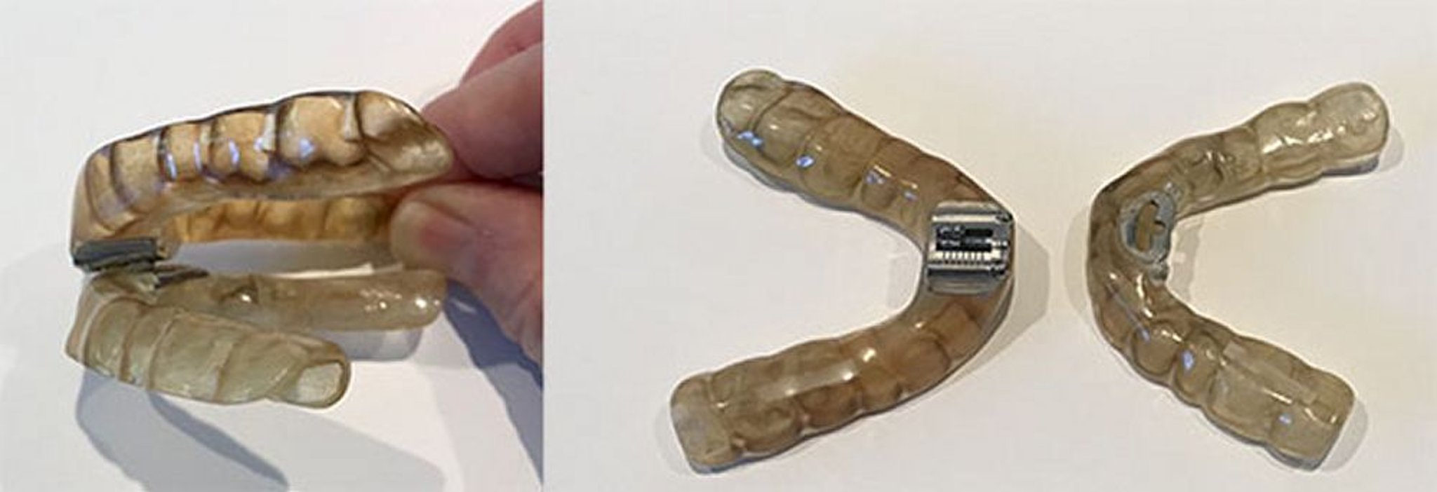 स्लीप ऐप्निया के लिए मुंह के उपकरण