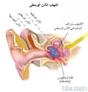 التهاب الأذن الوسطى