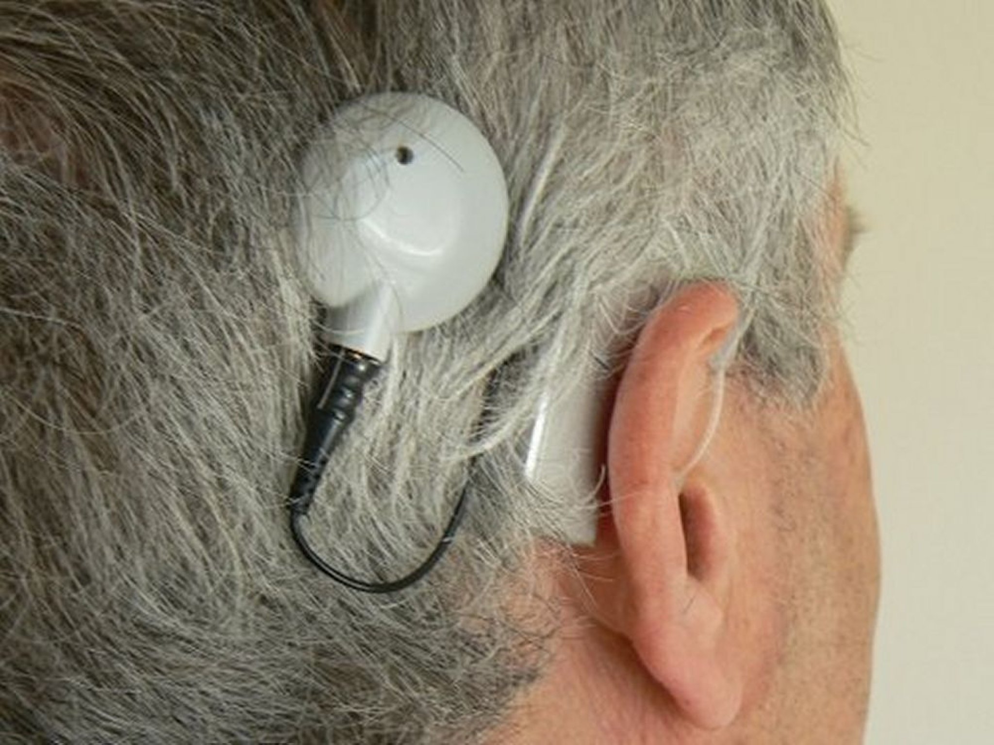 Person mit Cochlea-Implantat