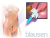 Pap-Test