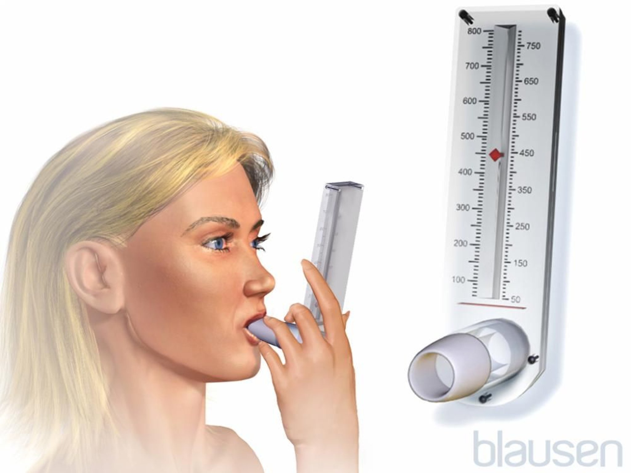 ピークフローメーター