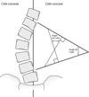 L’angle de Cobb