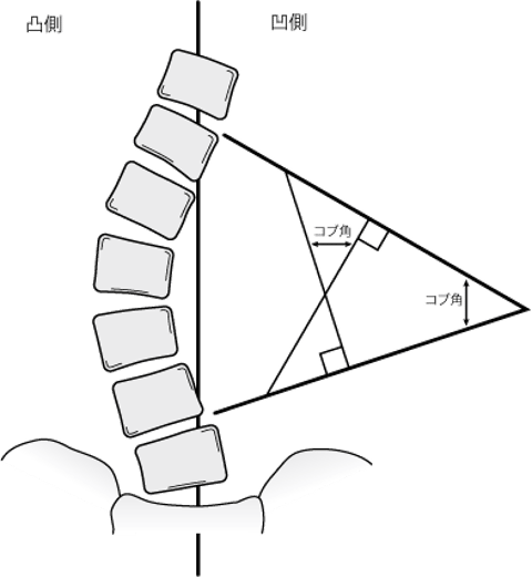 Imageコブ角MSDマニュアル プロフェッショナル版