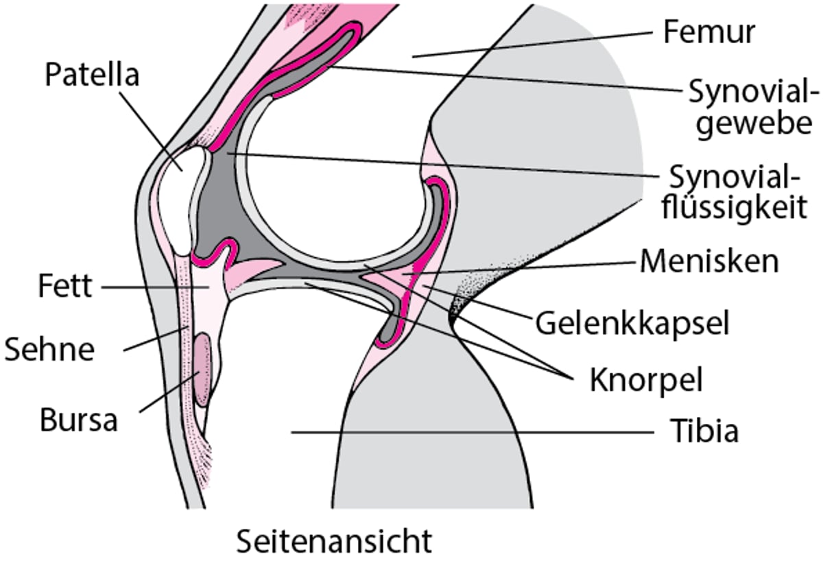 Im Inneren des Knies (Seitenansicht)