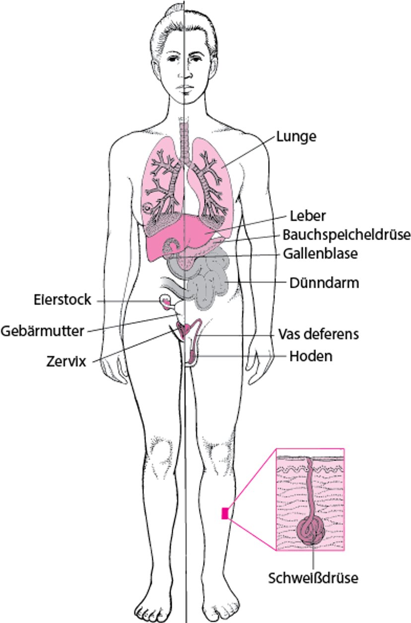 Mukoviszidose: mehr als eine Erkrankung der Lunge