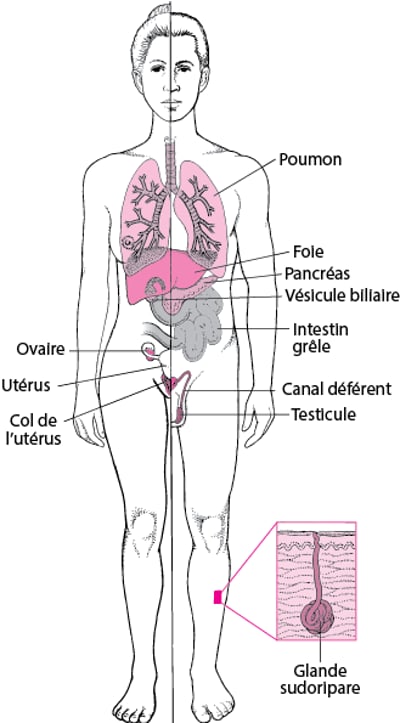 La mucoviscidose : Plus qu’une maladie pulmonaire