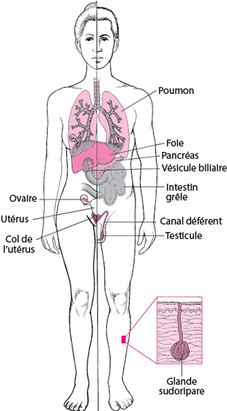 La mucoviscidose : Plus qu’une maladie pulmonaire