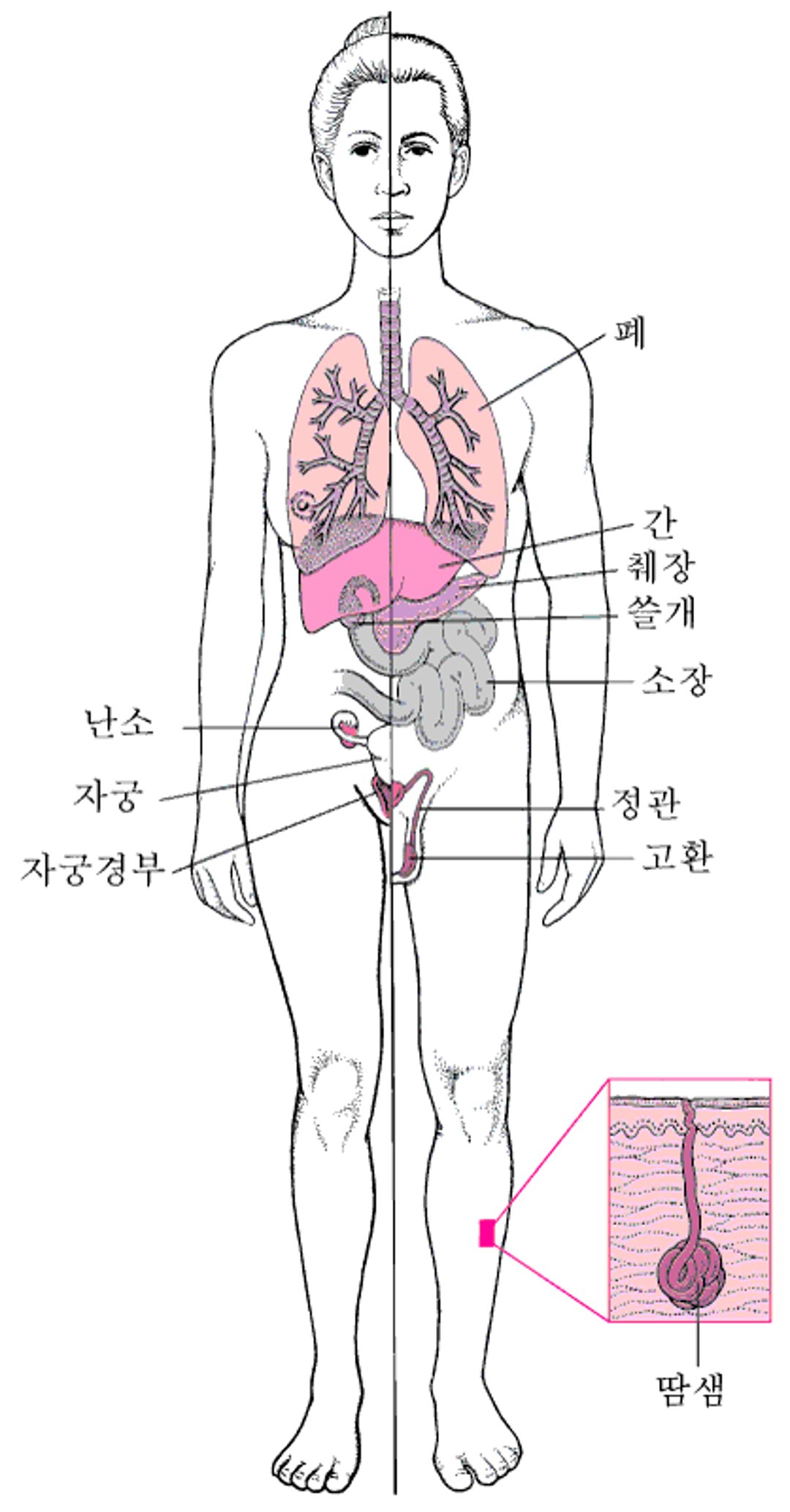 낭성 섬유증: 단순한 폐질환이 아닙니다.