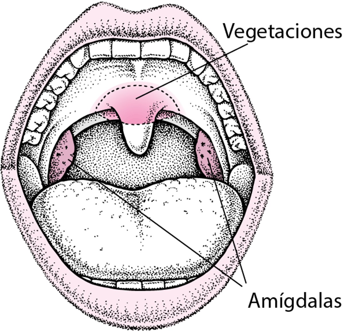 Localización de las amígdalas y las adenoides
