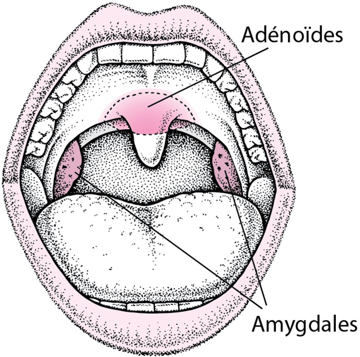 Situation des amygdales et des végétations adénoïdes