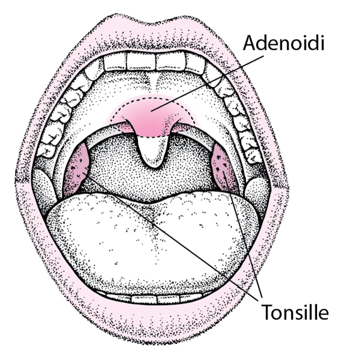 Localizzazione di tonsille e adenoidi