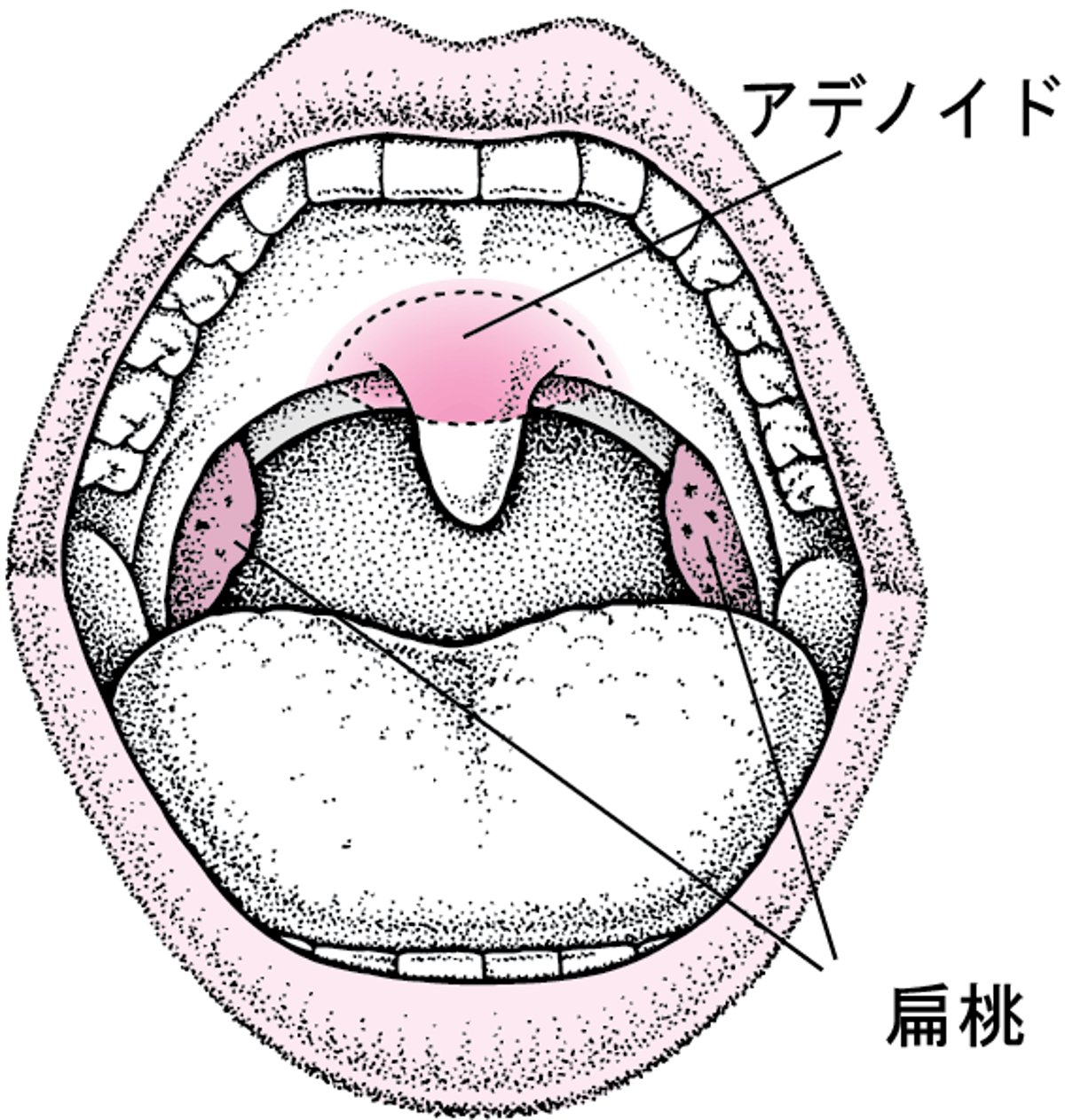 扁桃とアデノイドの位置