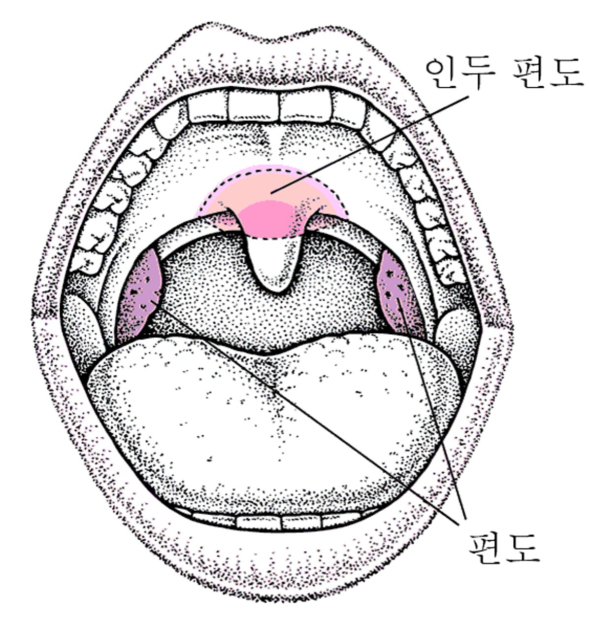 편도 및 인두편도 위치