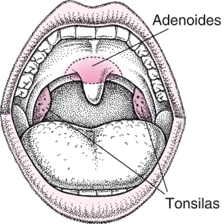 Localização das amígdalas e das adenoides