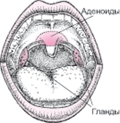 Расположение миндалин и аденоидов