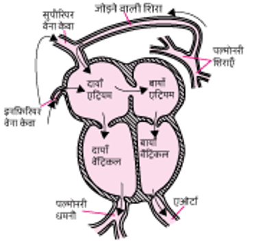 टोटल एनोमलस पल्मोनरी वीनस रिटर्न