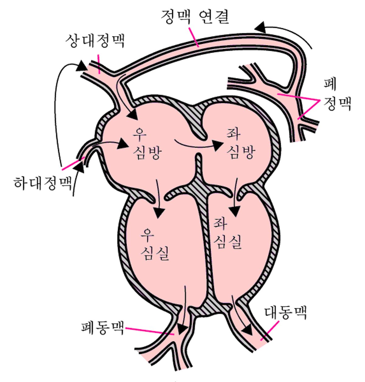 전폐정맥 환류 이상