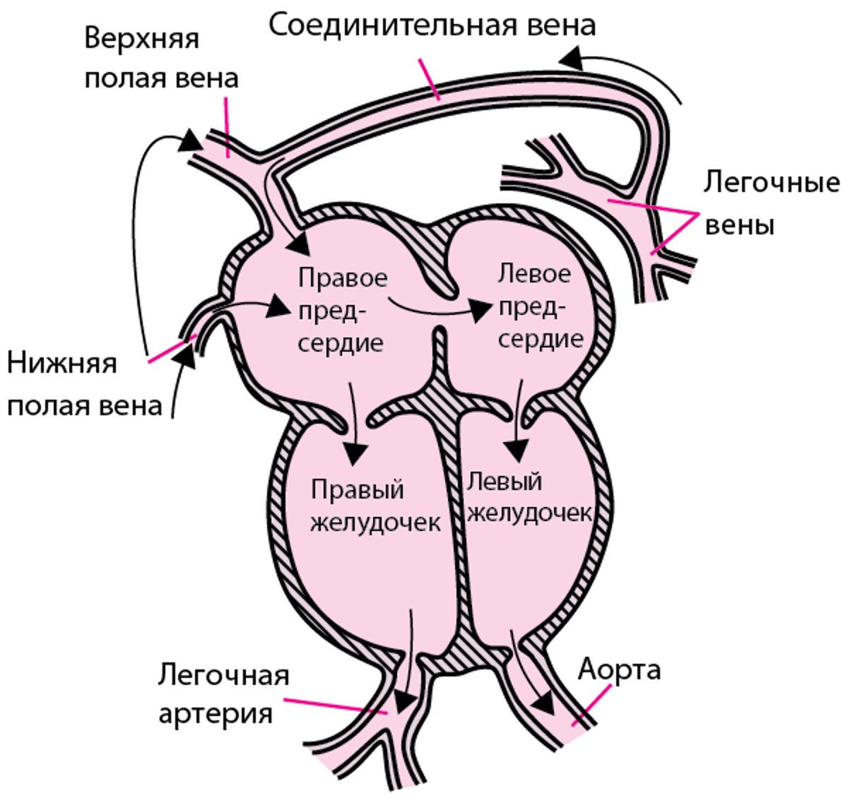 Тотальный аномальный легочный венозный возврат