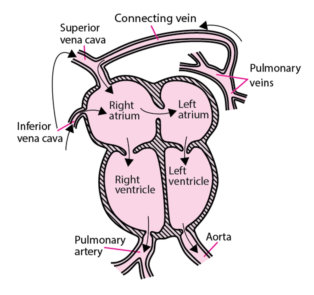 全肺静脉回流异常