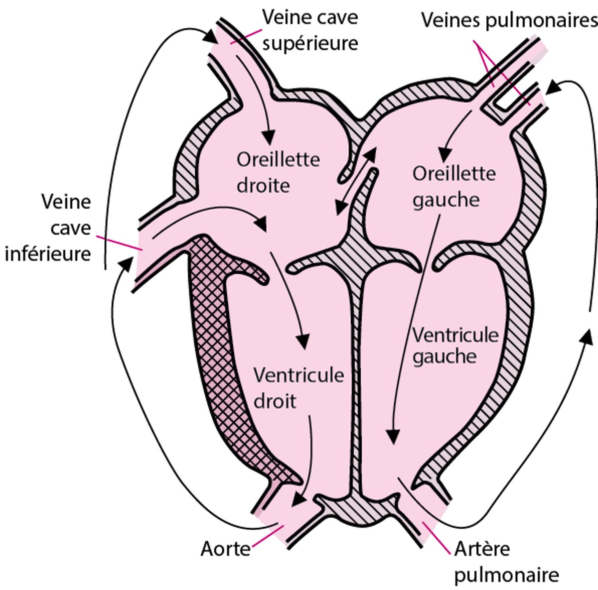 Transposition des grosses artères