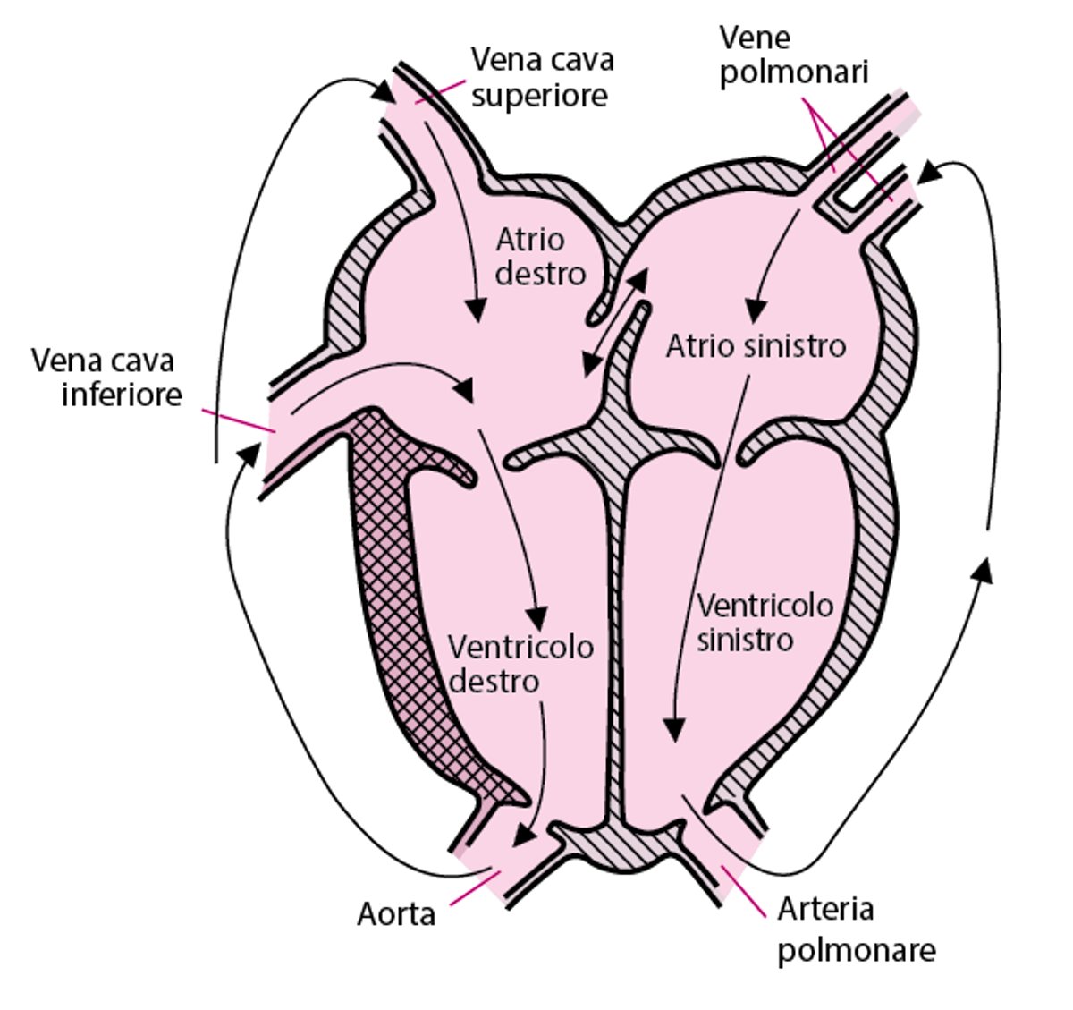 Trasposizione delle grandi arterie