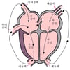대혈관 전위