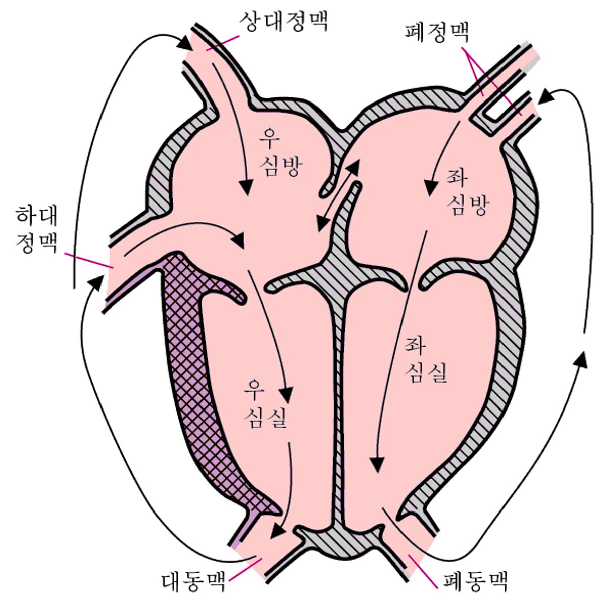 대혈관 전위