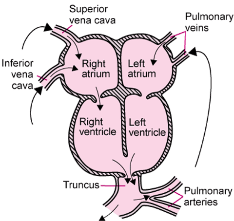 Image:Persistent Truncus Arteriosus-Merck Manual Consumer Version