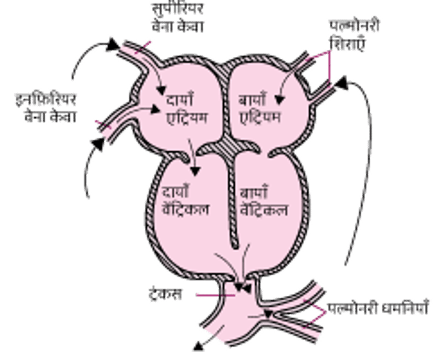 परसिस्टेंट ट्रंकस आर्टिरियोसस