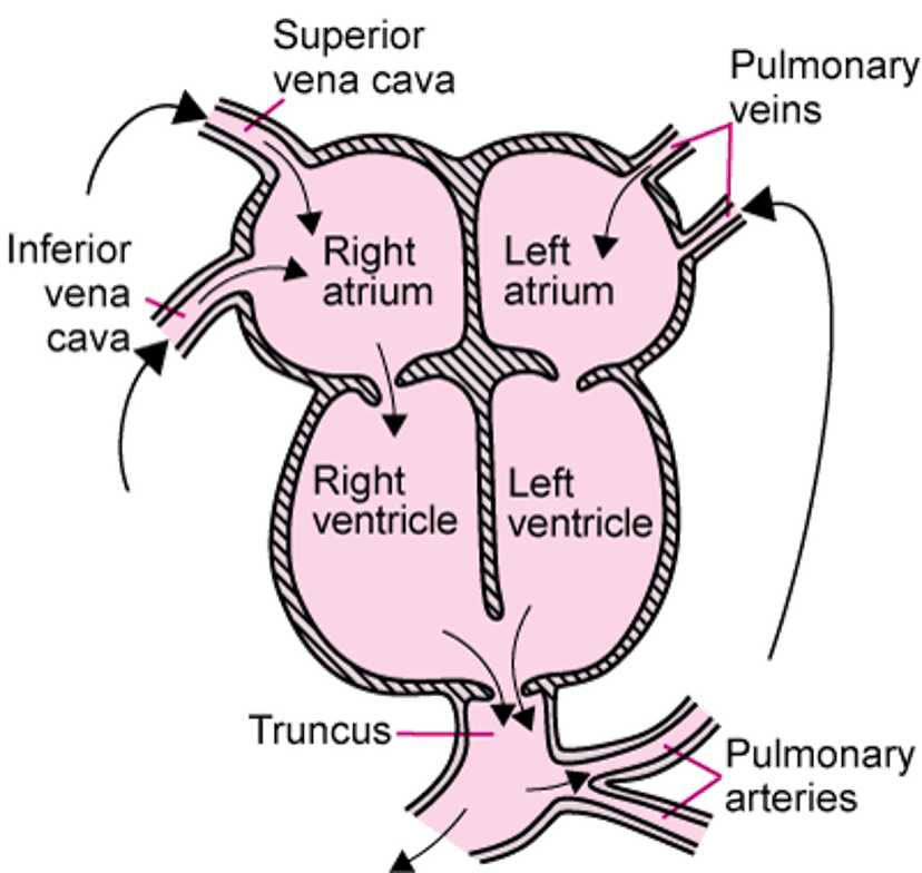 Truncus arteriosus persisten