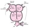 Tronco arterioso persistente