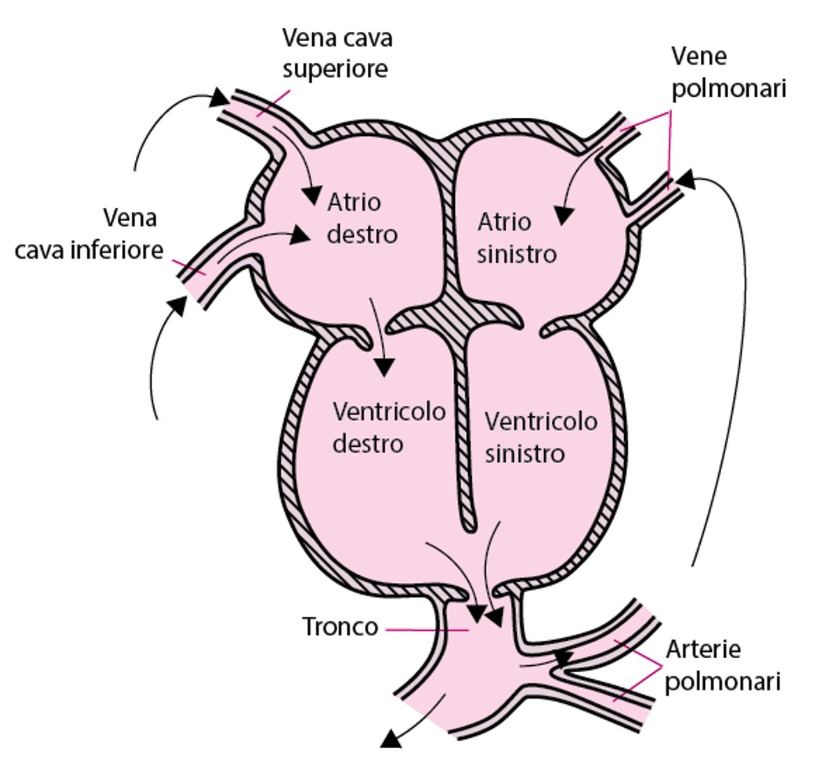 Tronco arterioso persistente