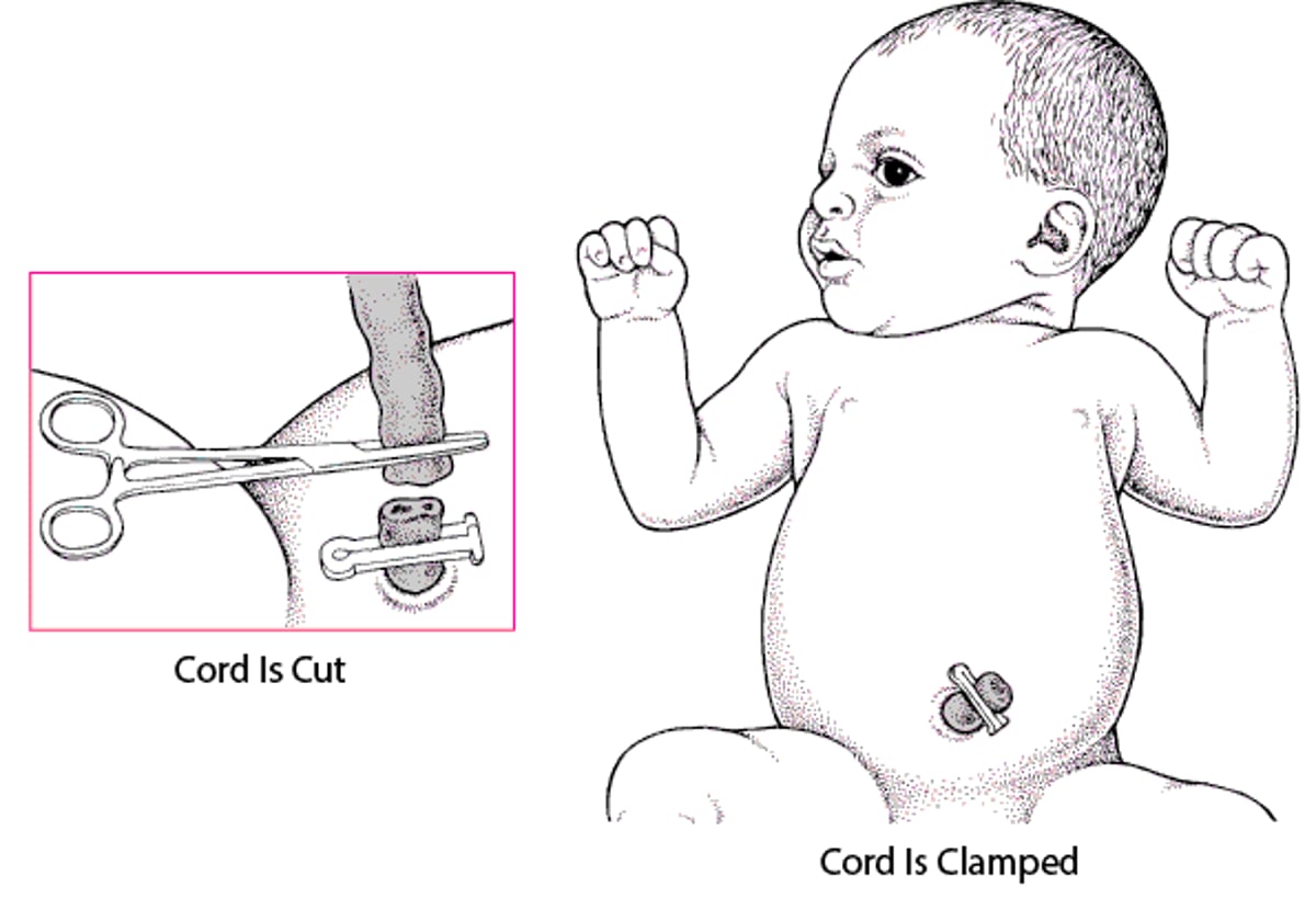 Cutting the Umbilical Cord