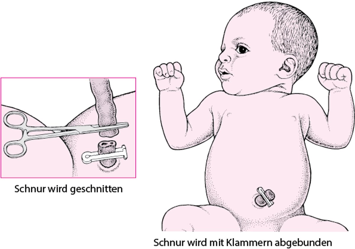 Durchtrennen der Nabelschnur