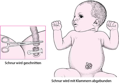 Durchtrennen der Nabelschnur